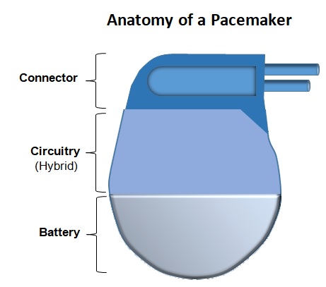 Anatomy of a Pacemaker